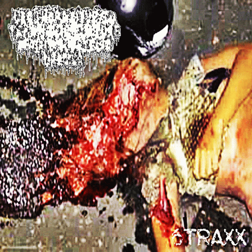 Acanthosis Nigrcans : 6Traxx Acanthosis Nigrcans : 6Traxx